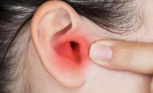 耳朵痒痒老想抠的怎么回事？主要有四大原因导致，快来看看你是哪种