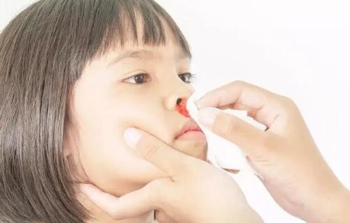 小孩流鼻血什么原因造成的？常与四种原因有关，家长要注意